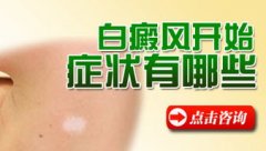 <b>女性白癜风，用心诊疗比用药诊疗更管用</b>