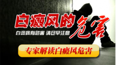 白癜风对青少年的影响大吗?