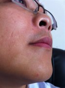 白癜风散发有规律吗？发病缘由是什么