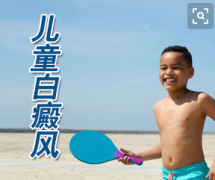 杭州儿童胸部白癜风的发病与年龄有关联吗